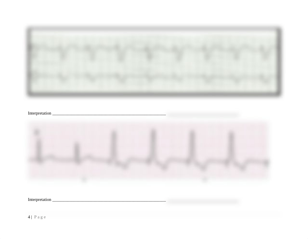 NUR 202 EKG Strip Student Practice copy.docx_dcm0n18ocgg_page4