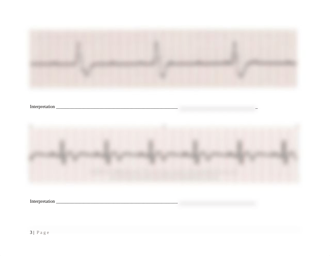 NUR 202 EKG Strip Student Practice copy.docx_dcm0n18ocgg_page3