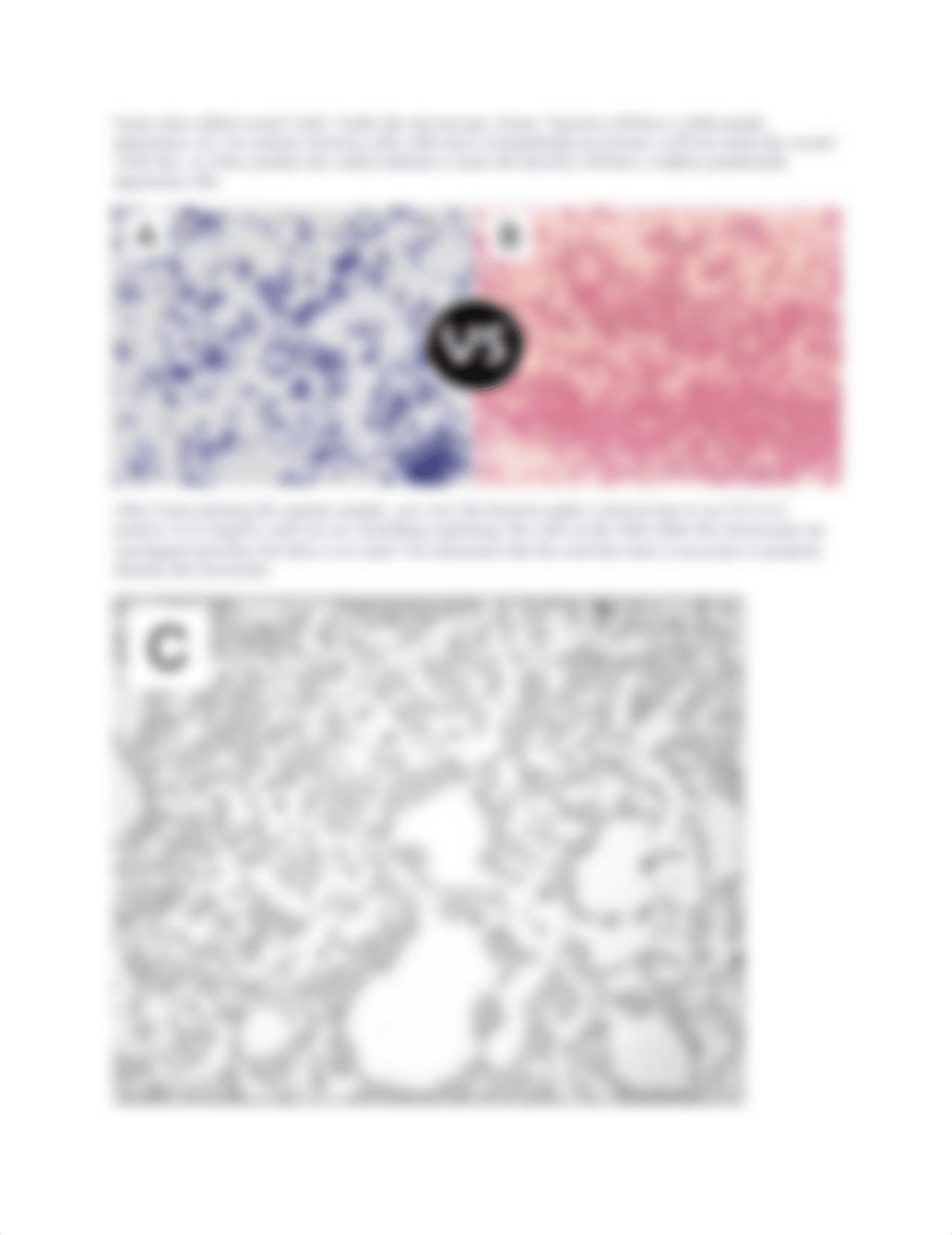 Module 2 Case Study - Up Against a Cell Wall.docx_dcpmmvy6rvk_page2