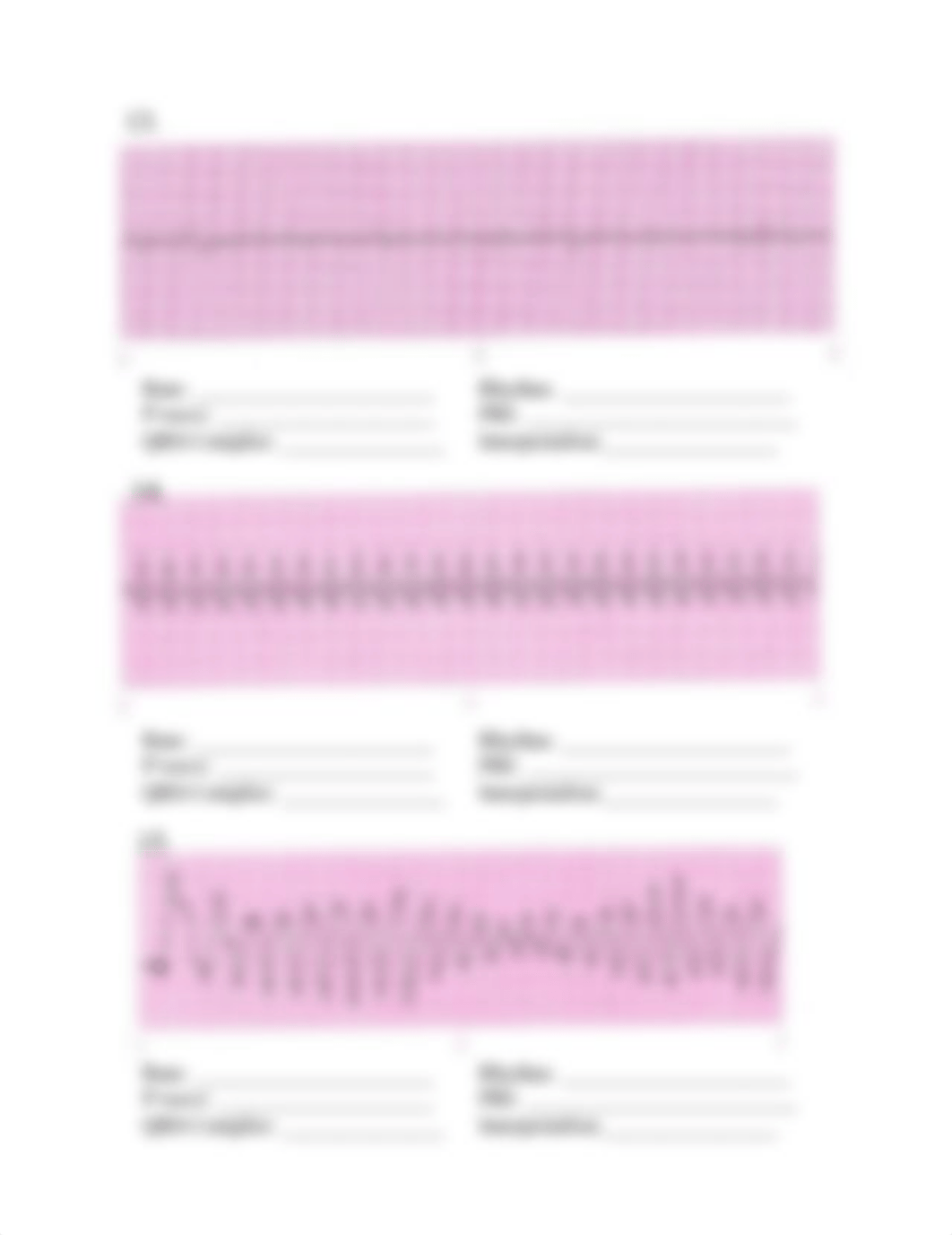 N164 EKG Practice.pdf_dcqknq9lhef_page5