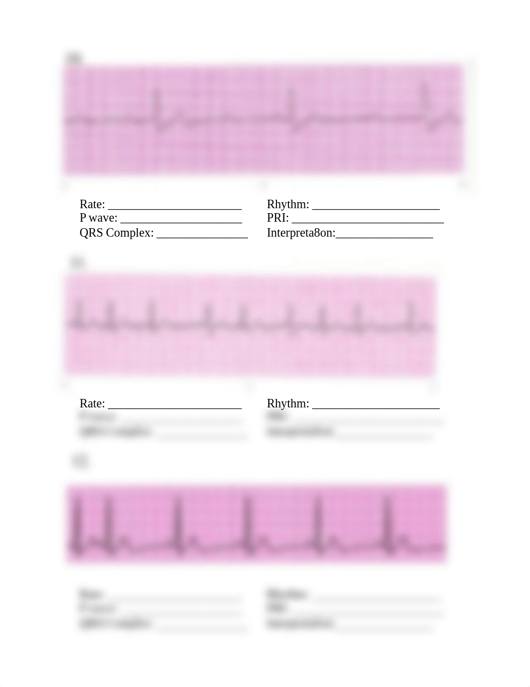 N164 EKG Practice.pdf_dcqknq9lhef_page4