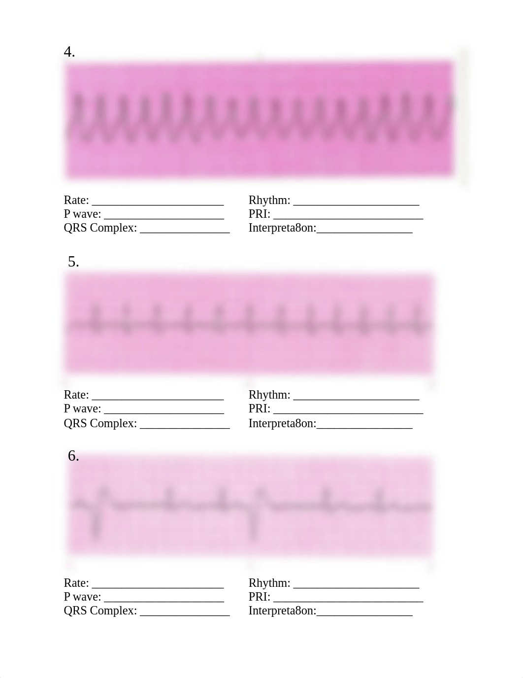 N164 EKG Practice.pdf_dcqknq9lhef_page2