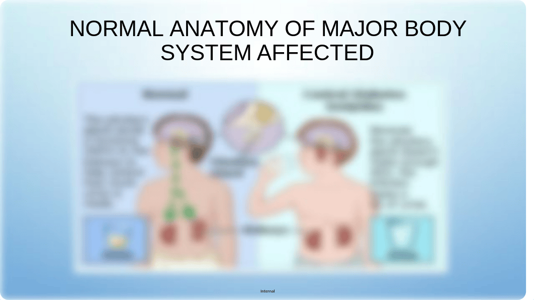 DIABETES INSIPIDUS PPT.ppt_dctil78bibj_page2