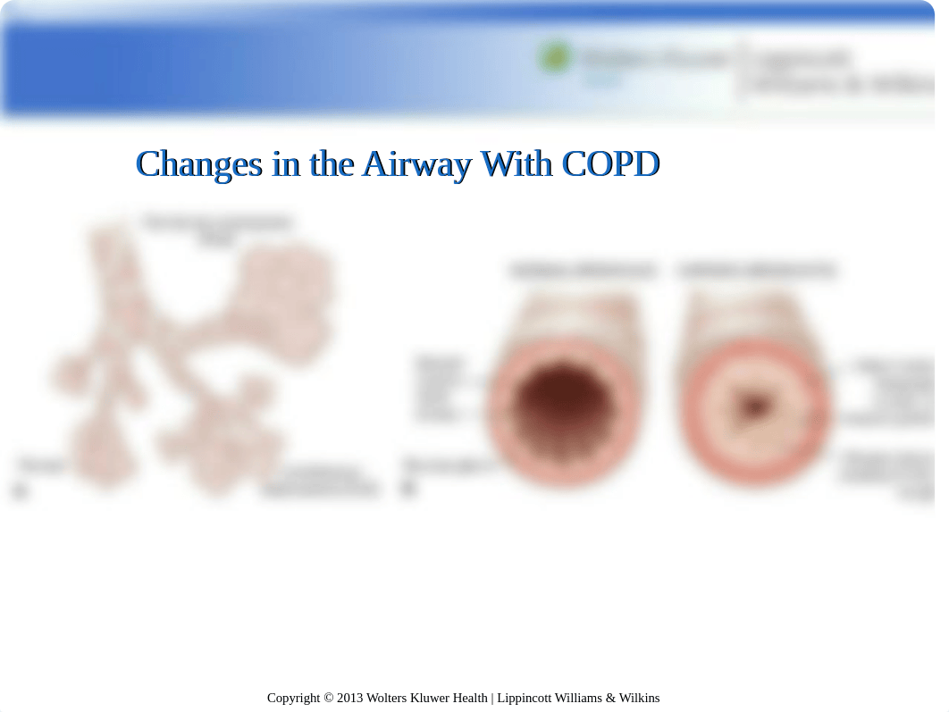 Karch Chapter 55.ppt_dctjv3wdnts_page2