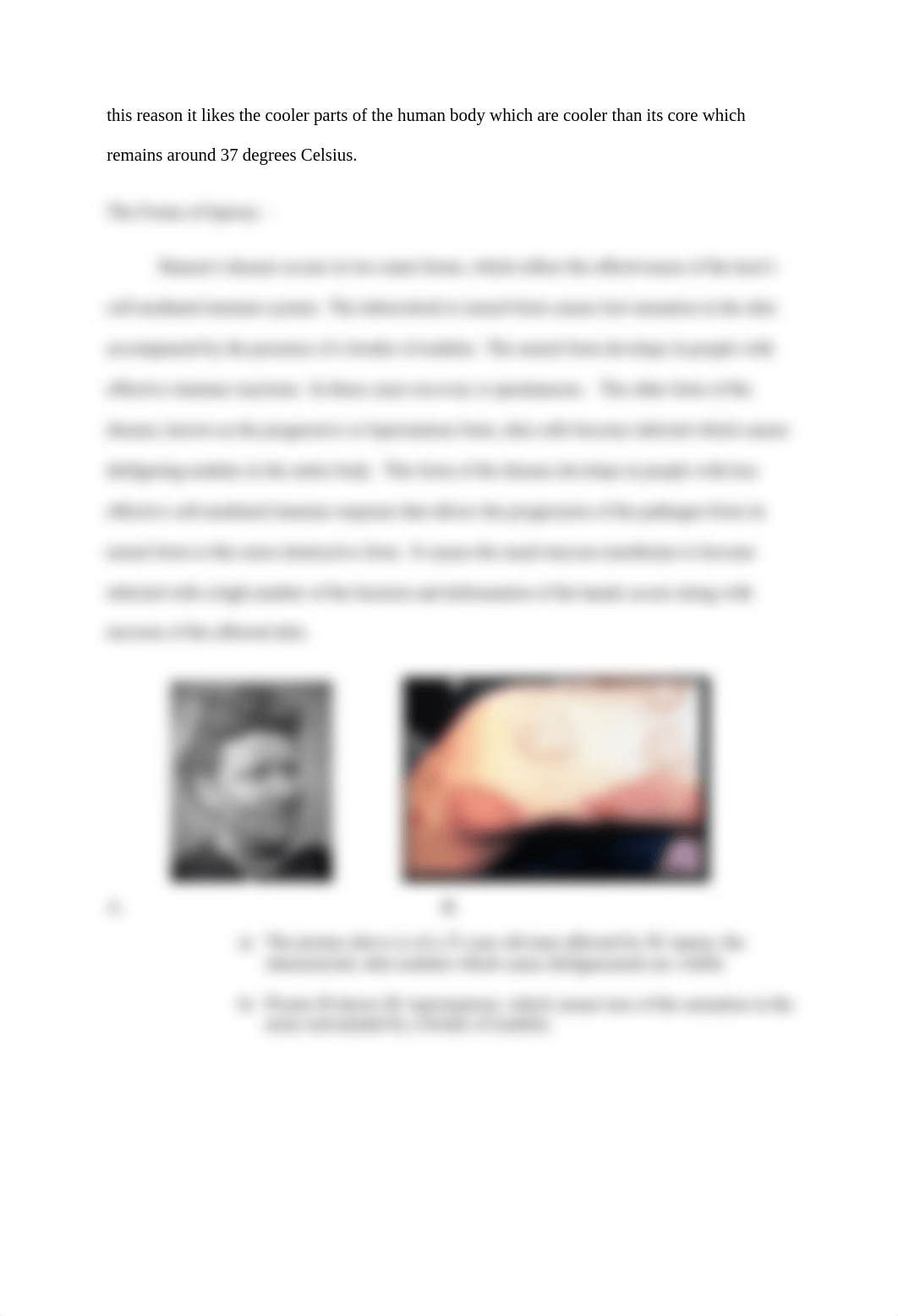 Disease Assignment (Leprosy)_dcu0gn6nc89_page2