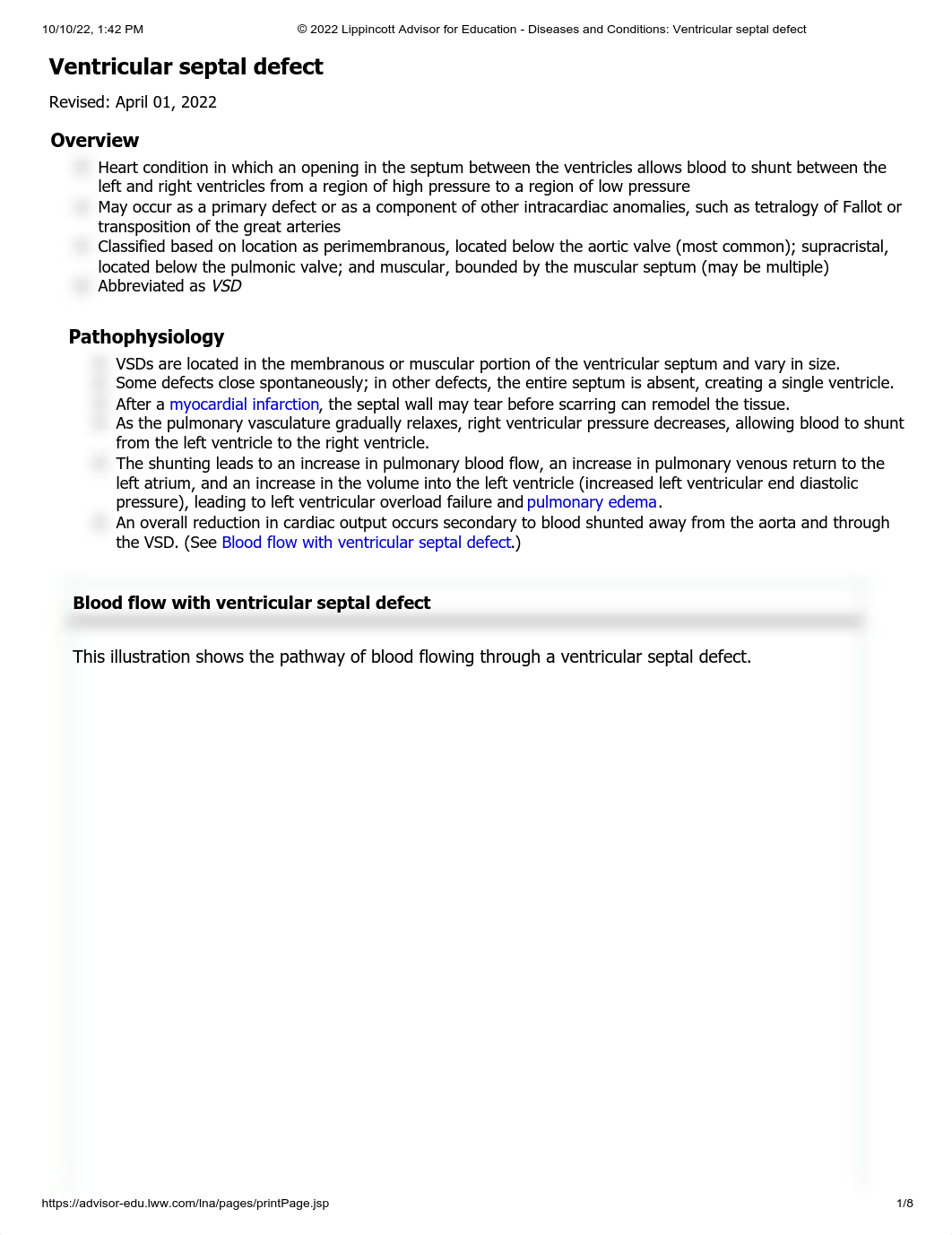 Ventricular septal defect.pdf_dcvwc3osppx_page1