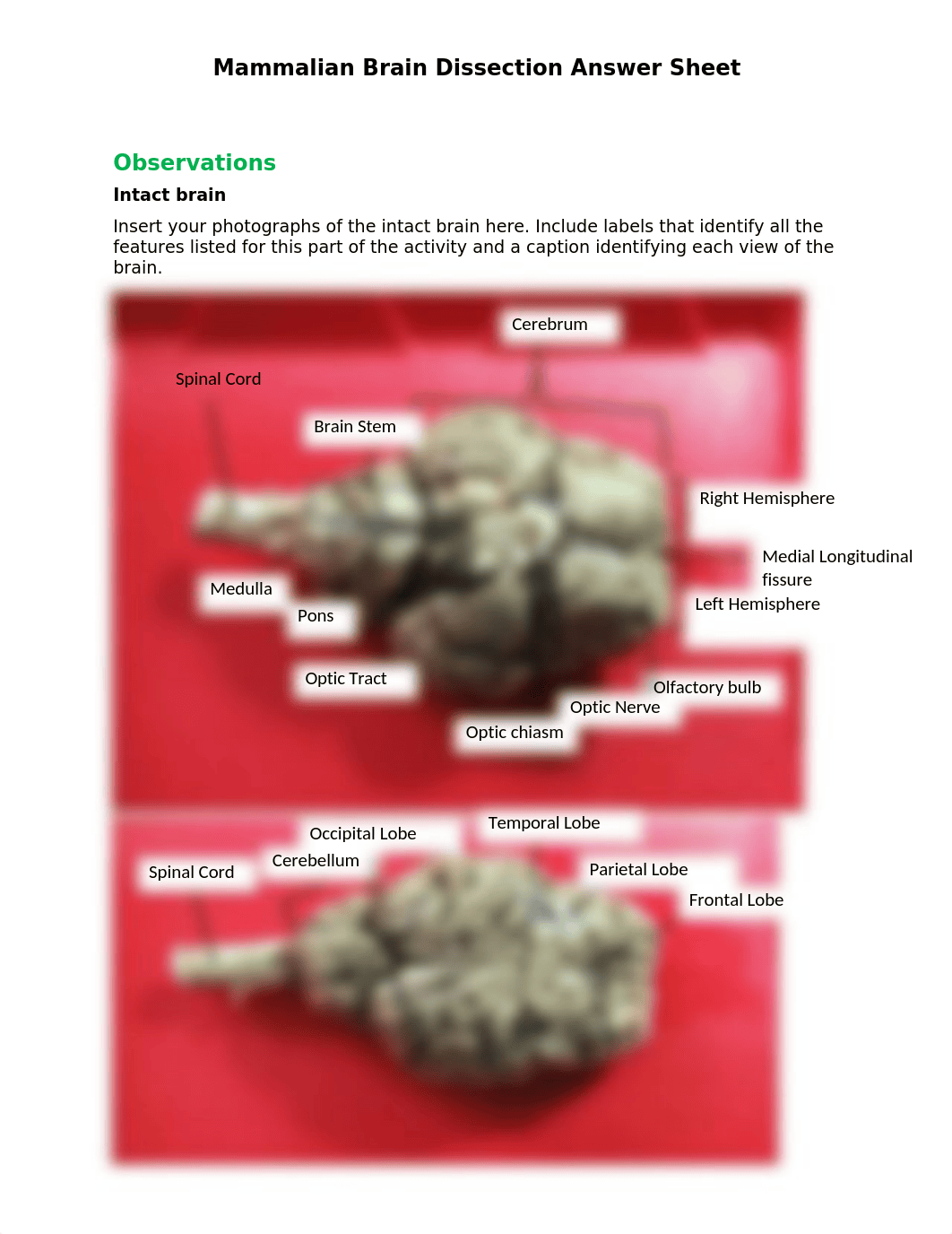 Brain Dissection Answer sheet - complete.docx_dd0rlst0dsq_page2