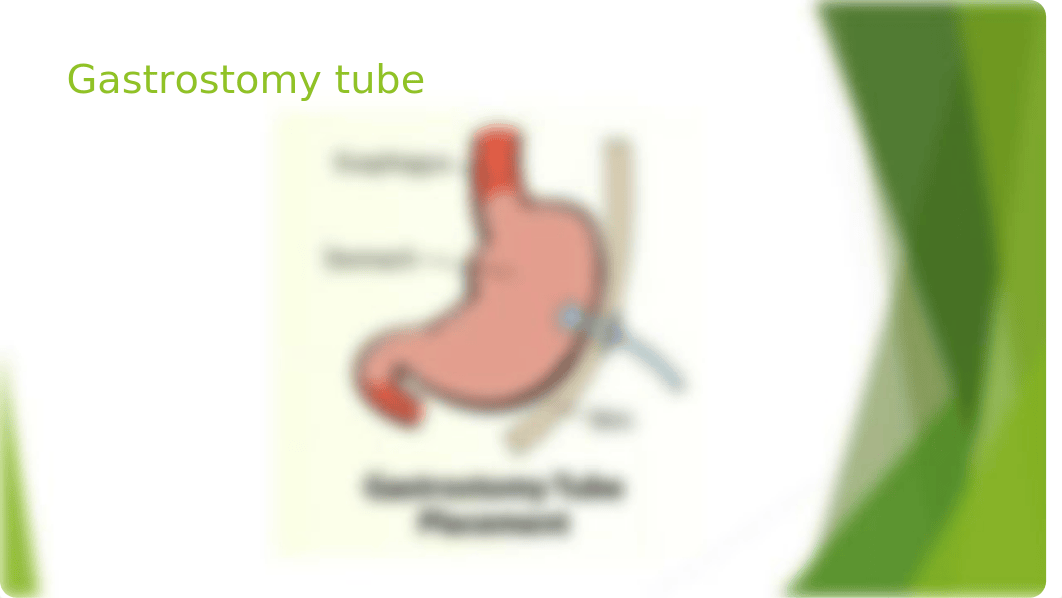 Administering Medications via Gastrostomy tube.pptx_ddbel8cfkp8_page2