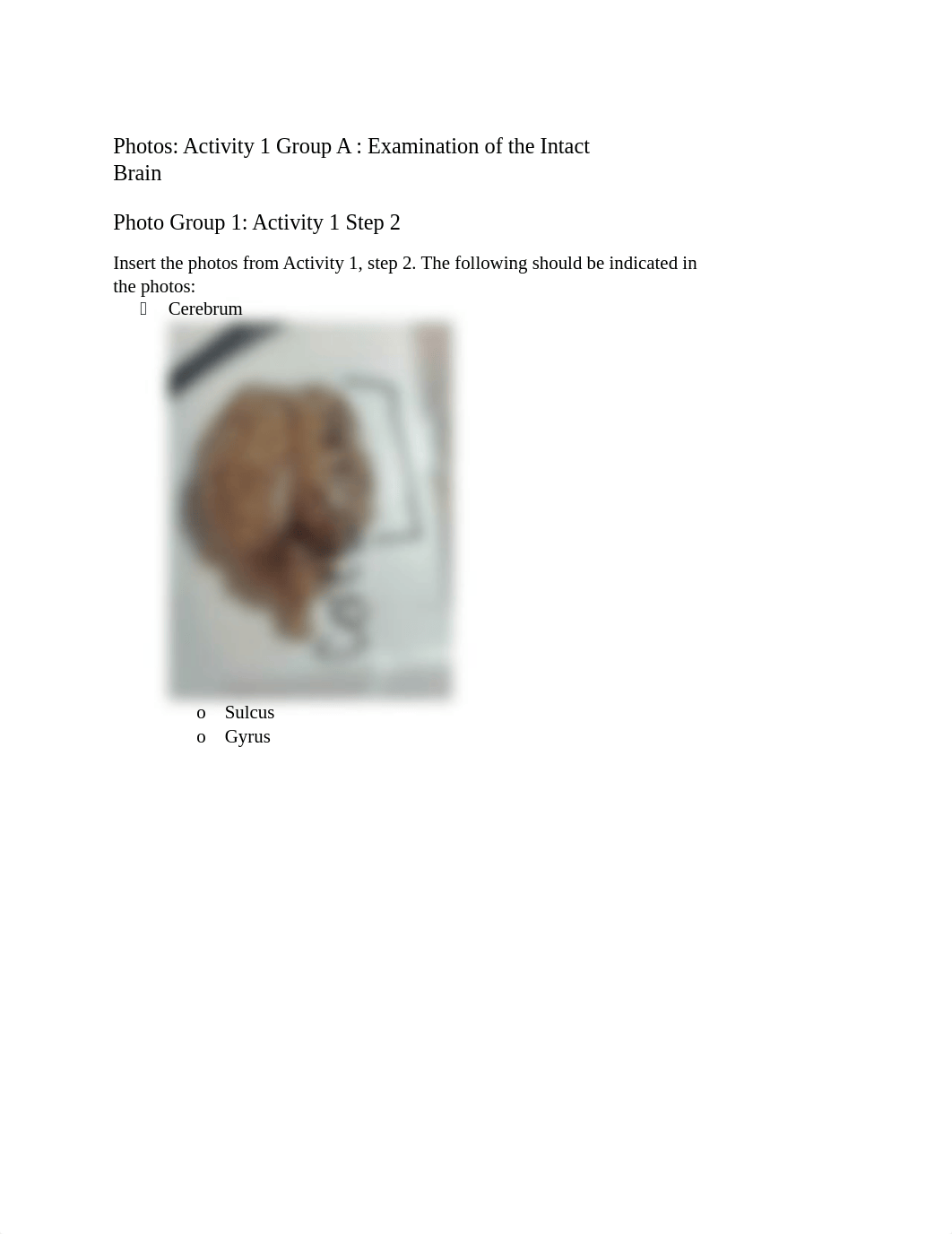 BIO 137 Anatomy of the Brain Report.docx_ddby89fjg18_page2