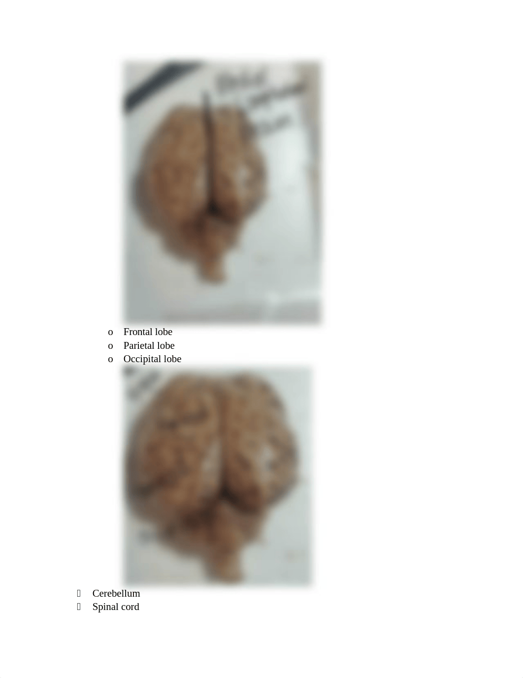 BIO 137 Anatomy of the Brain Report.docx_ddby89fjg18_page4