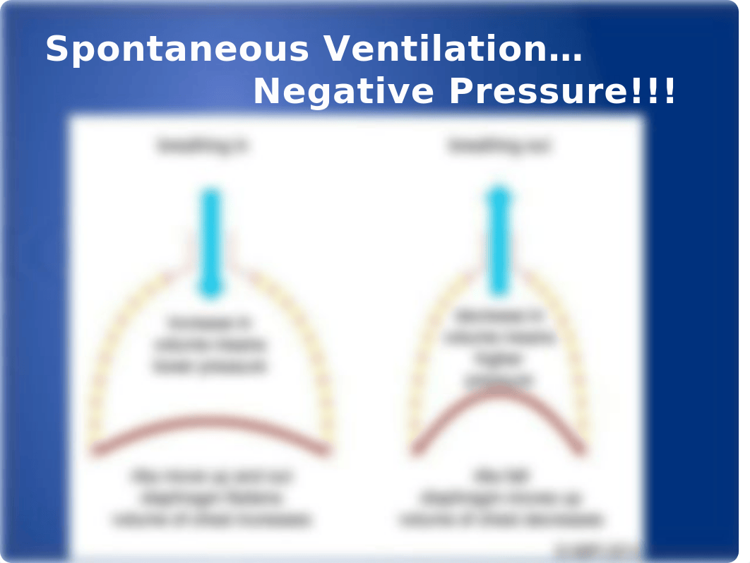 Mechanical Ventilation Exercise (3) and lecture.pptx_dde6kbosdp2_page3