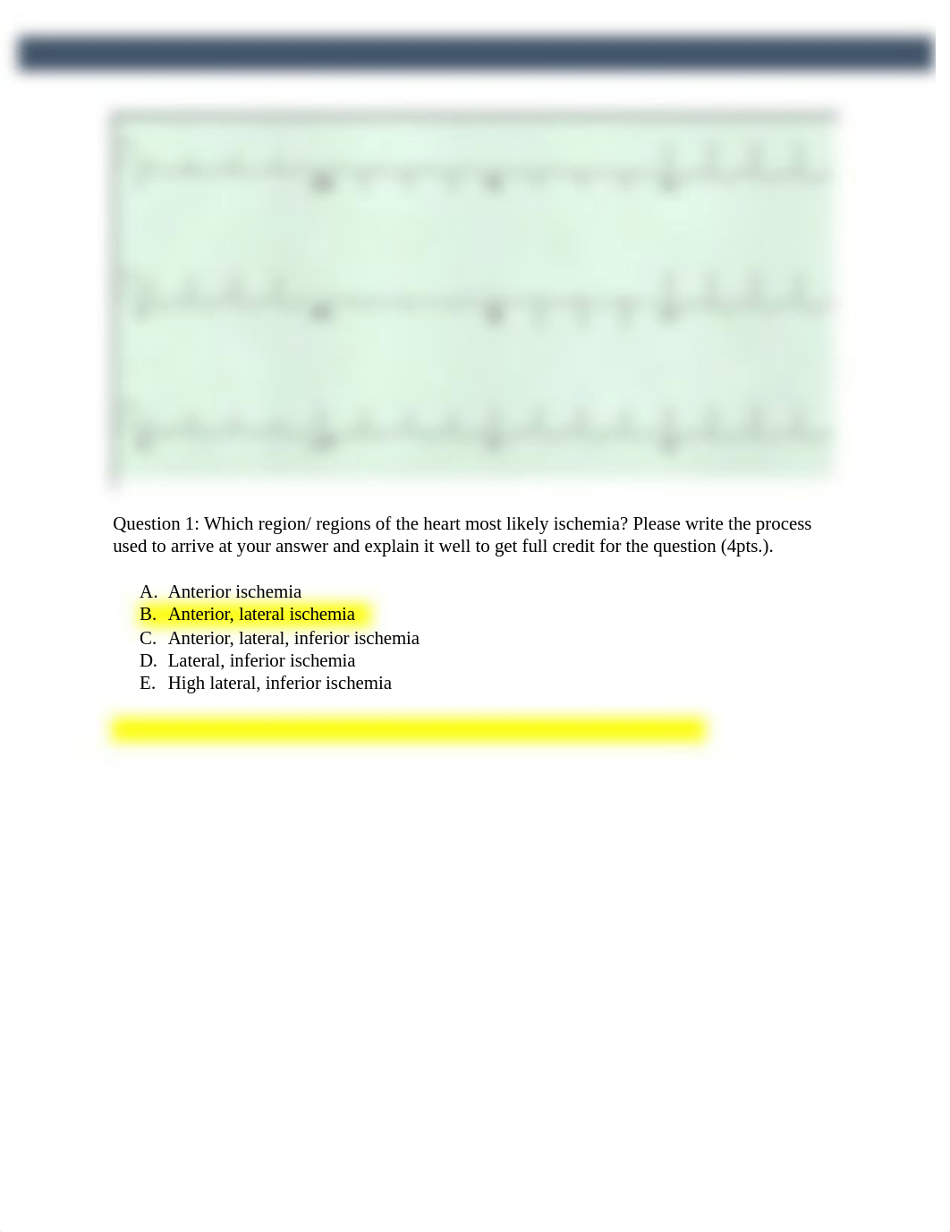 EKG Assignment 2 Resubmission .docx_ddjwd421xi7_page1