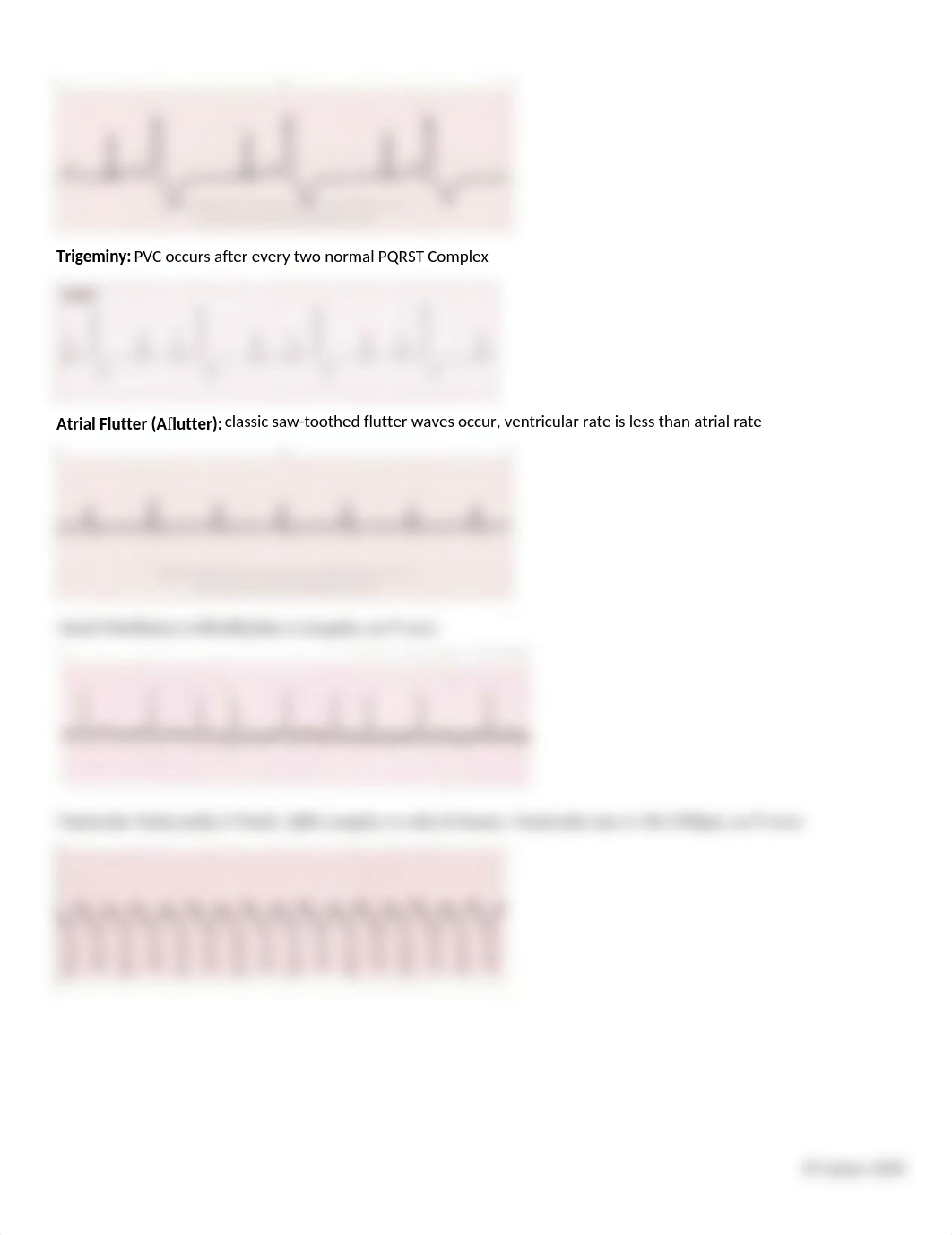 EKG Interpretation.docx_ddm14fmes5b_page3