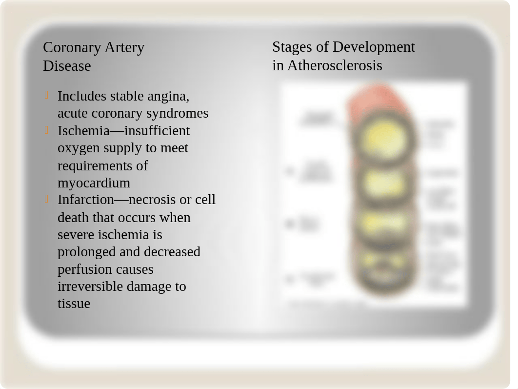 Ch 38 Care of Patients with Acute coronary syndrome.pptx_ddnd6p6wjrh_page2