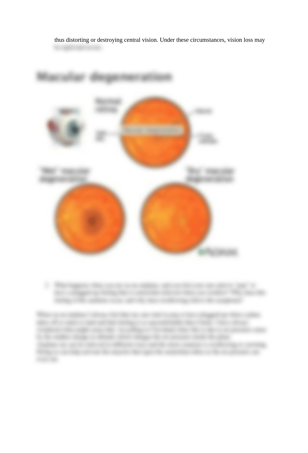 macular degeneration.docx_ddsnmbb97jr_page2