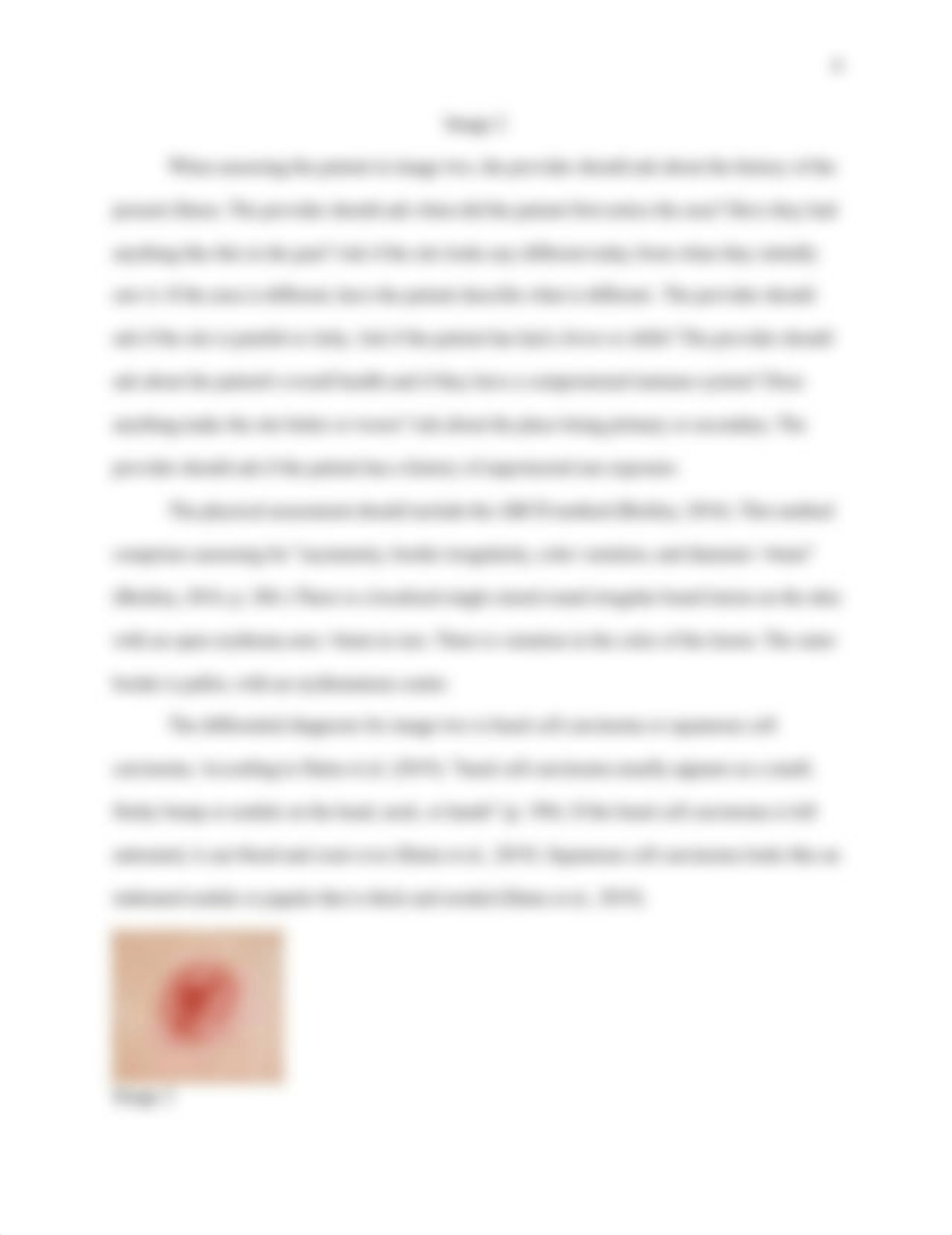 NUR602_Miller_D_Dermatology2.docx_de13a8dfuhl_page4