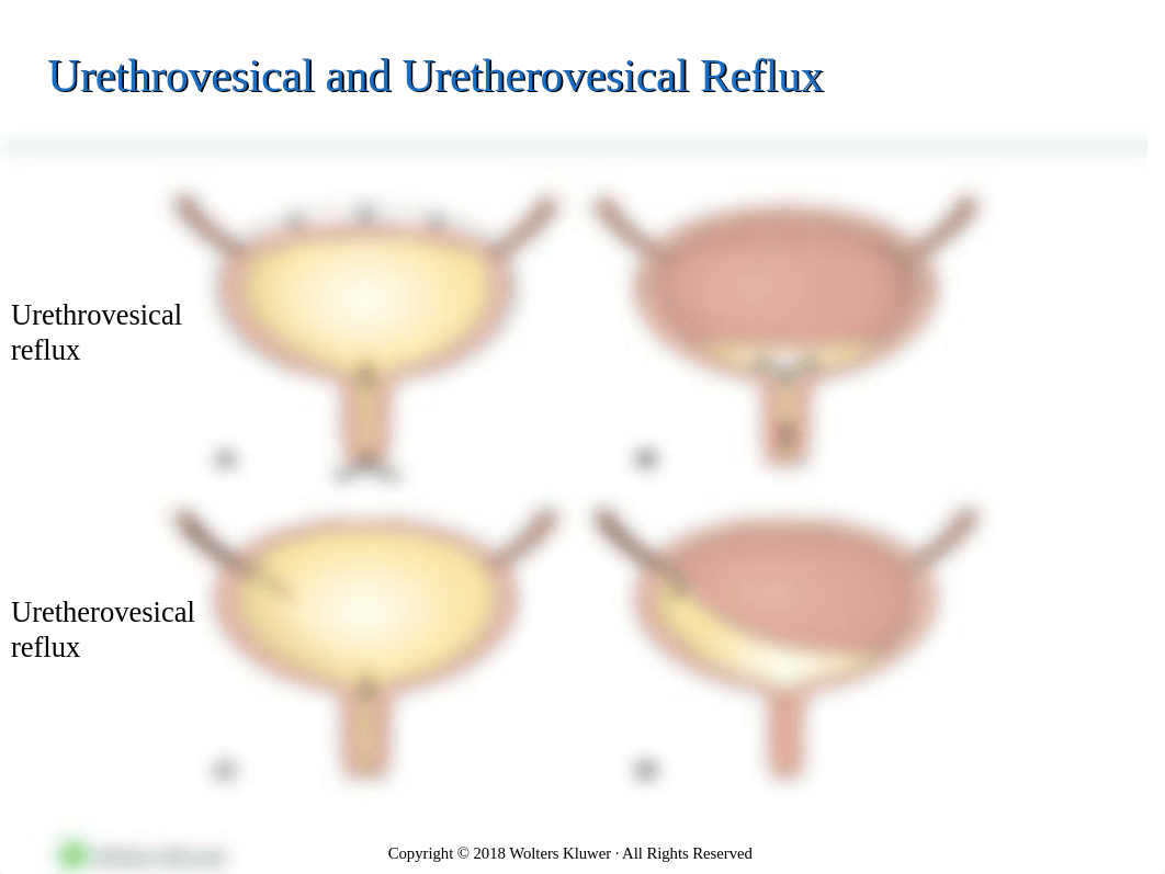 PPT_Chapter55.ppt_de38lmfbfwf_page4