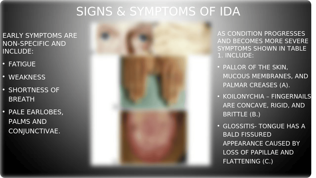 patho week 3 Iron Deficiency Anemia (IDA).pptx_decbspgzzeo_page2