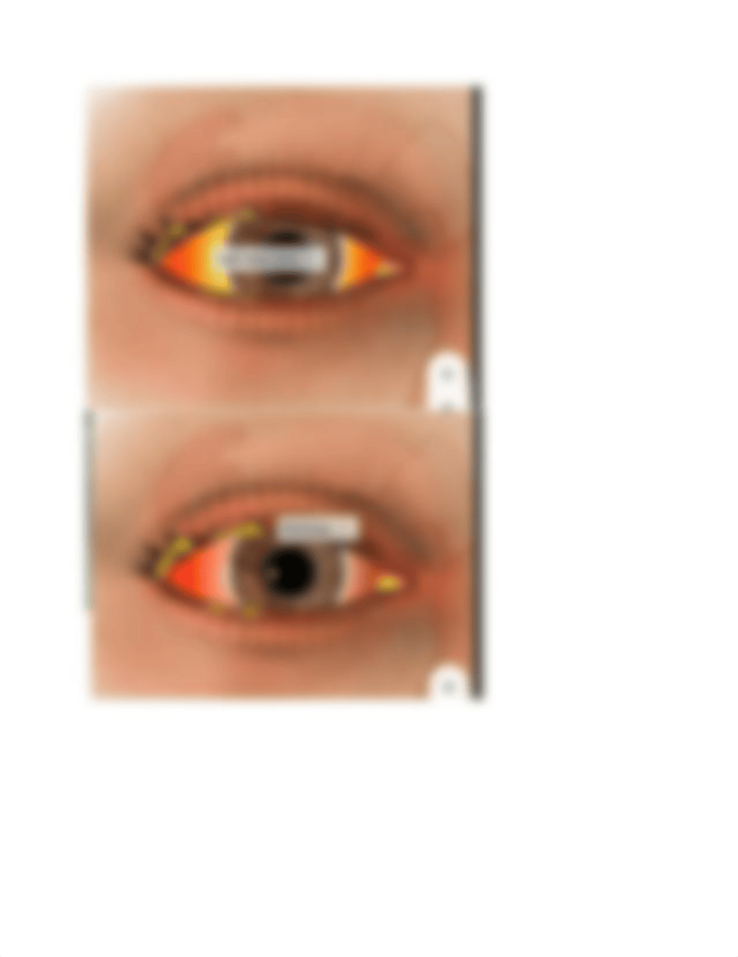 Eye Case Study.docx_decot6aqz8j_page2