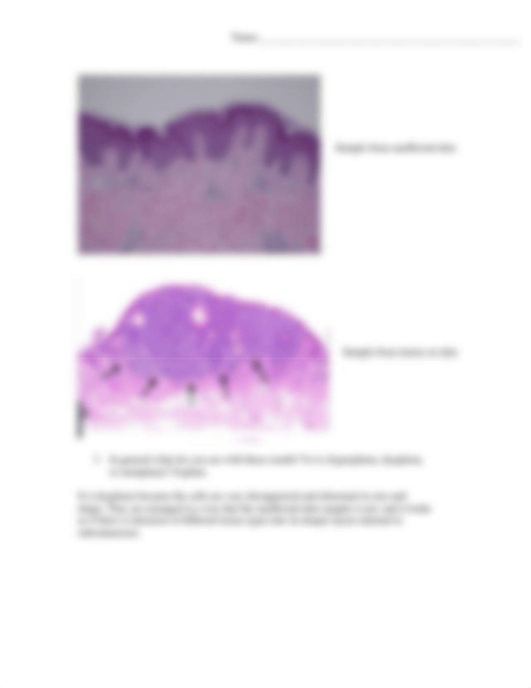 Neoplasia case study.docx_def9t4xm6qd_page3