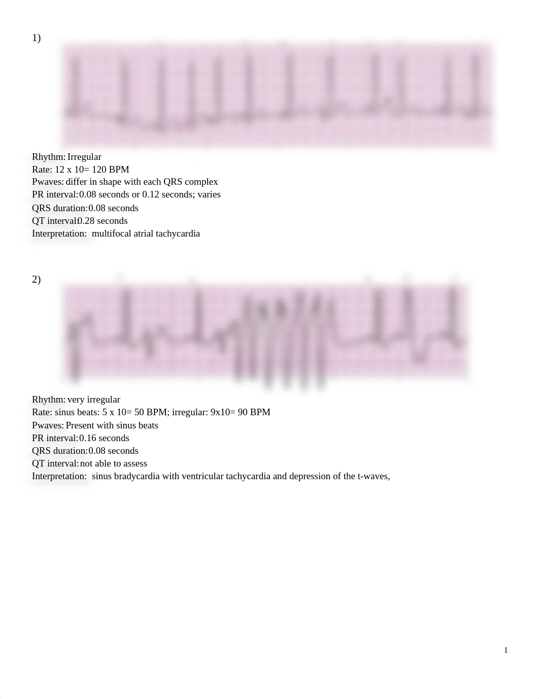 NURADN 404 ECG.docx_defc3qeh2o6_page1