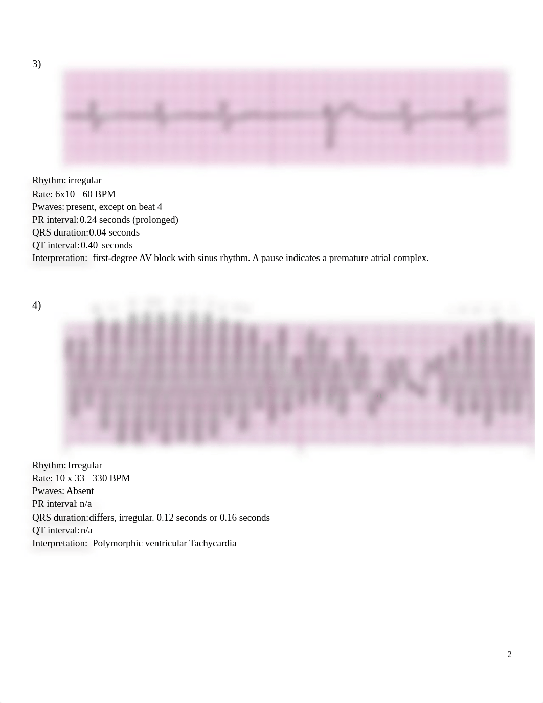 NURADN 404 ECG.docx_defc3qeh2o6_page2