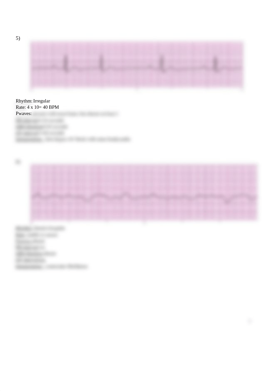 NURADN 404 ECG.docx_defc3qeh2o6_page3