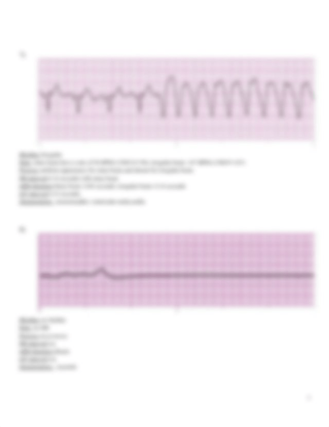 NURADN 404 ECG.docx_defc3qeh2o6_page4