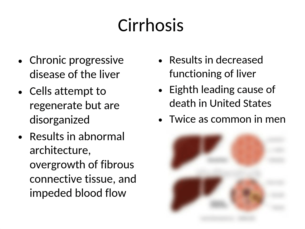 Cirrhosis_dep7666ejnb_page2