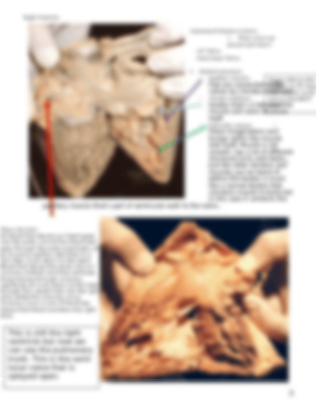 Lecture 1 - Cardiac Anatomy.doc_desodmsf8vg_page3