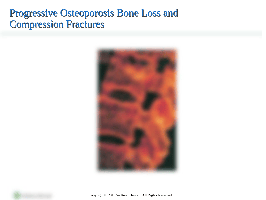 NURS206_Musculoskeletal (1).ppt_devpcg9asw8_page4