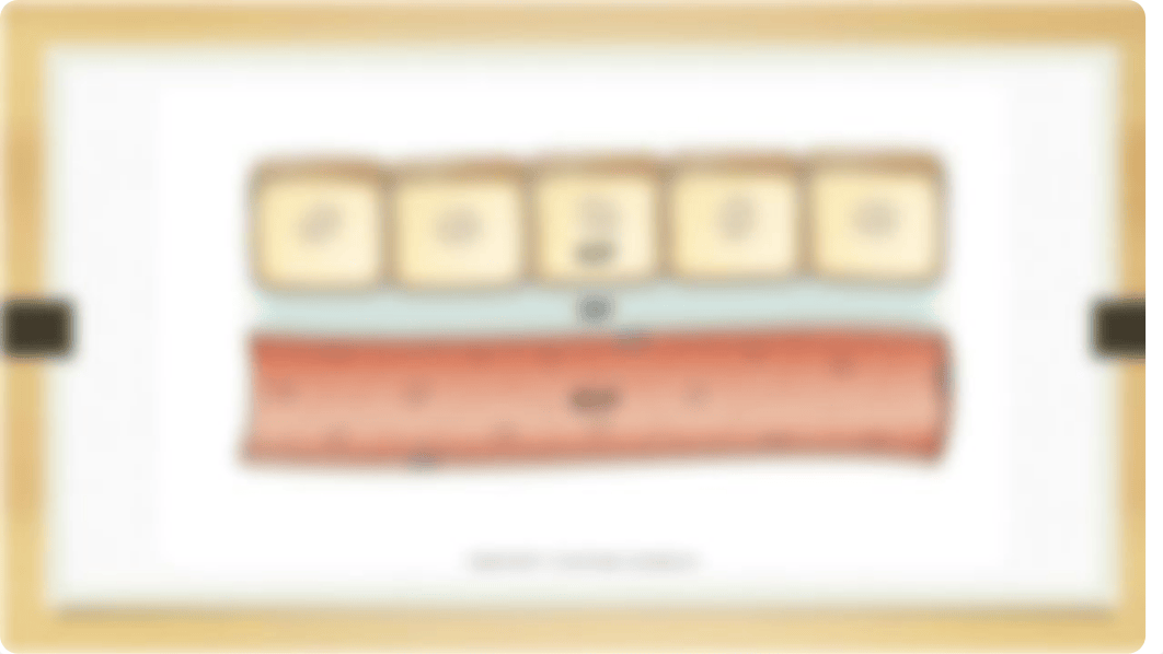 Fluid and Electrolytes-MW.pptx_dex473en95t_page5