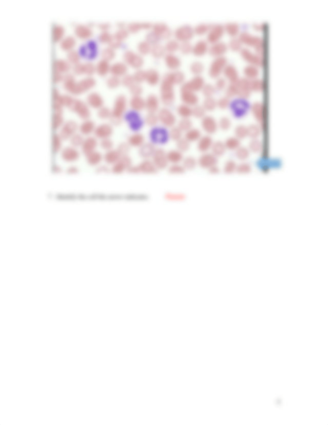 ASSN 8.4  MISCELLANEOUS BLOOD KEY.docx_deyvj2t0803_page5