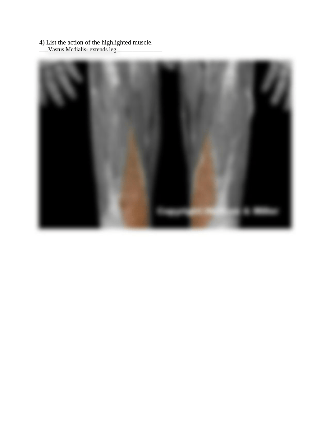 Lower limb muscke action .docx_df3qbad2hfb_page4