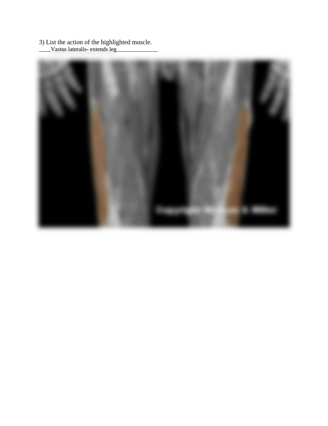 Lower limb muscke action .docx_df3qbad2hfb_page3