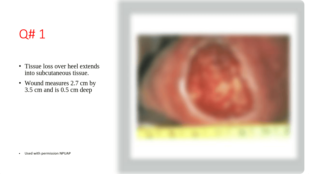 Lab 8_ Activity _Pressure Injury_ Ulcer _Test.pdf_df4c7cli6p1_page4