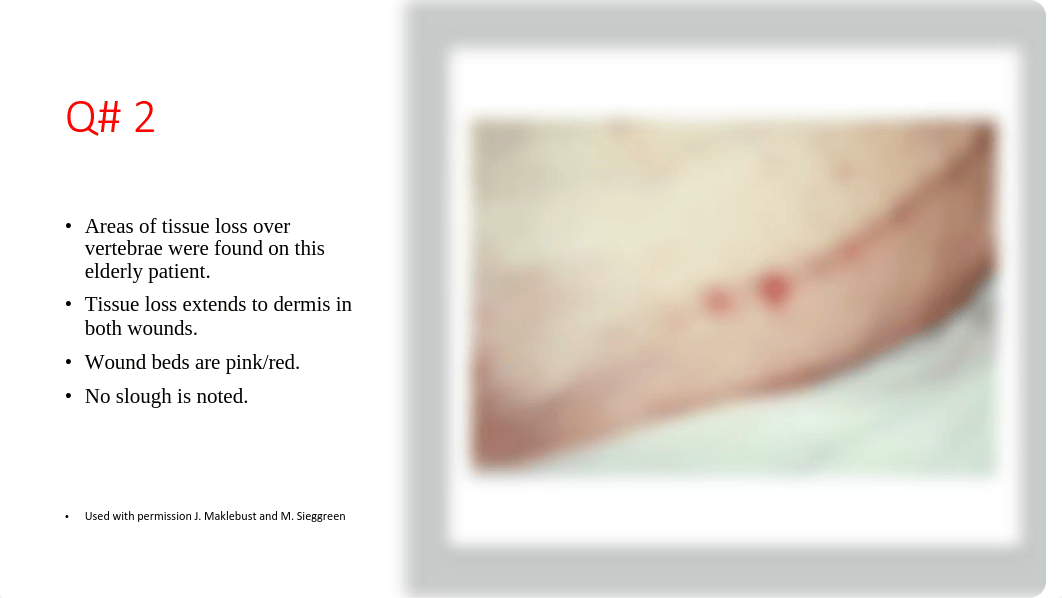 Lab 8_ Activity _Pressure Injury_ Ulcer _Test.pdf_df4c7cli6p1_page5