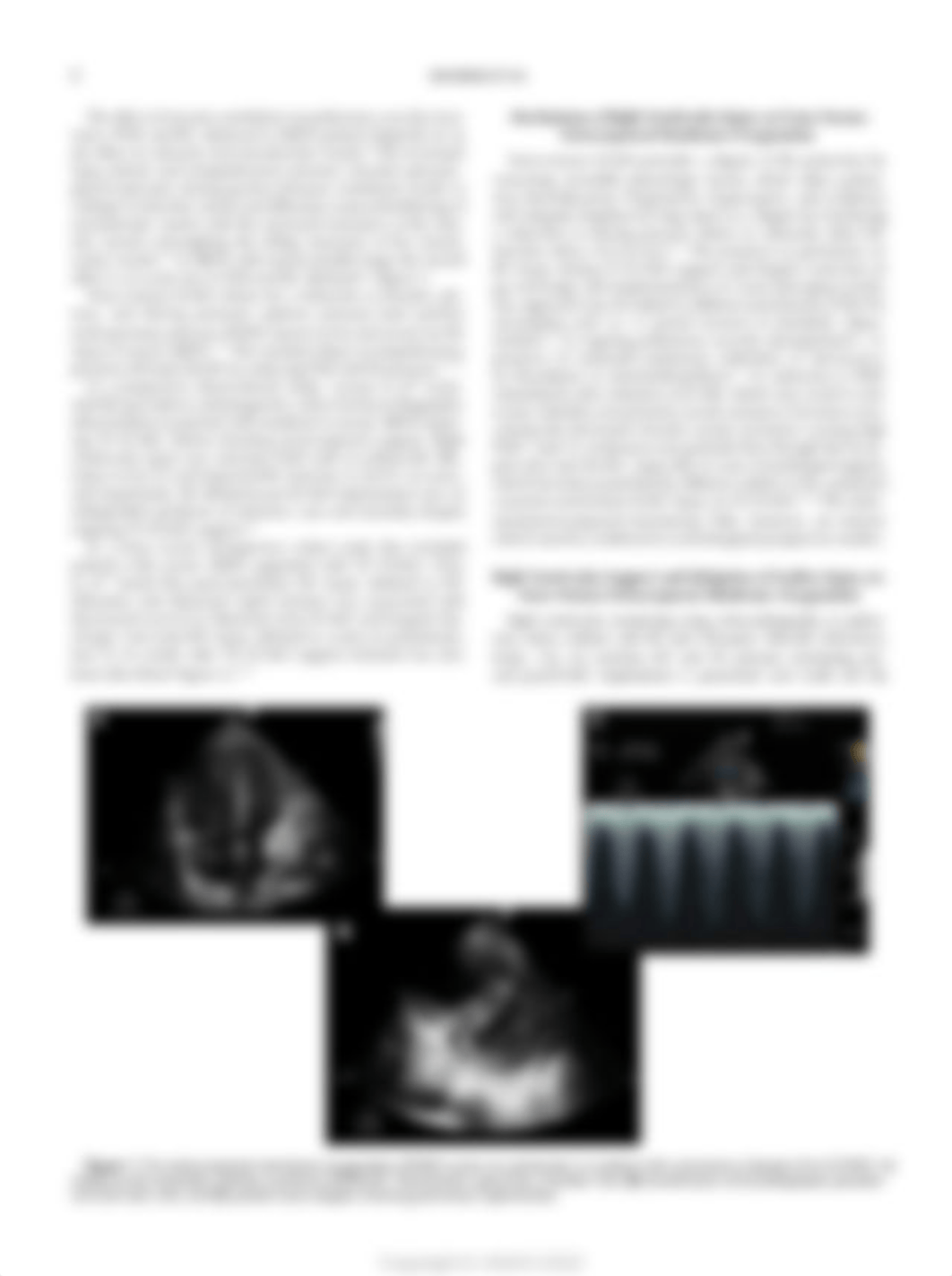 The Right Ventricle During Veno-Venous Extracorporeal Membrane Oxygenation in Acute Respiratory Dist_df6ckunp2et_page2