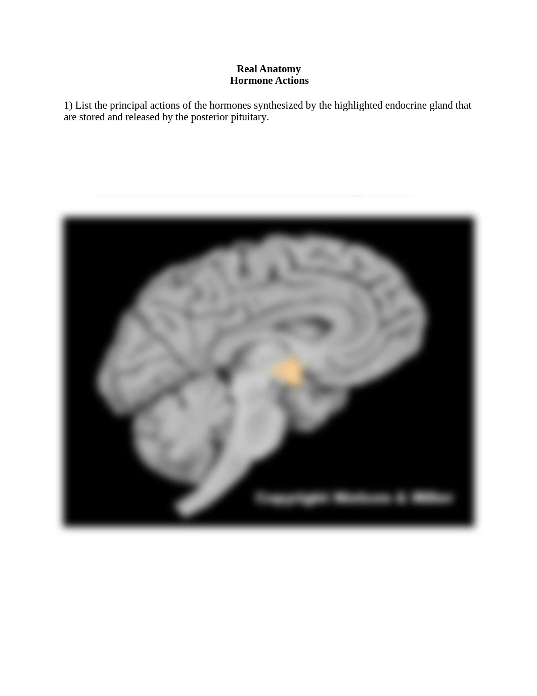 Hormone actions no ans worksheet.docx_df6mh1etas9_page1