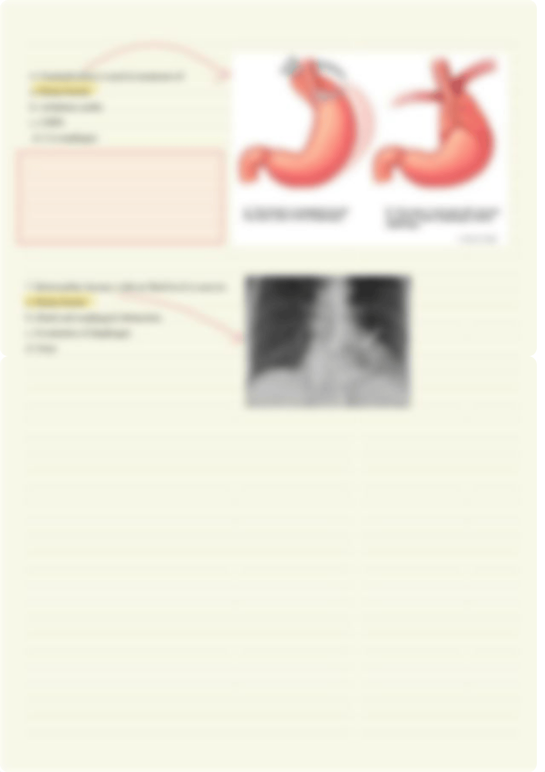 Esophagus Surgery Notes Part 1.pdf_df7l92nu7xr_page3