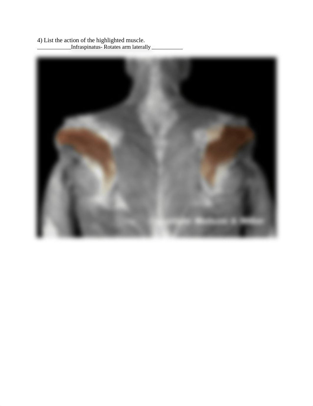 Upper limb muscle action.docx_dfd4oej5kux_page4