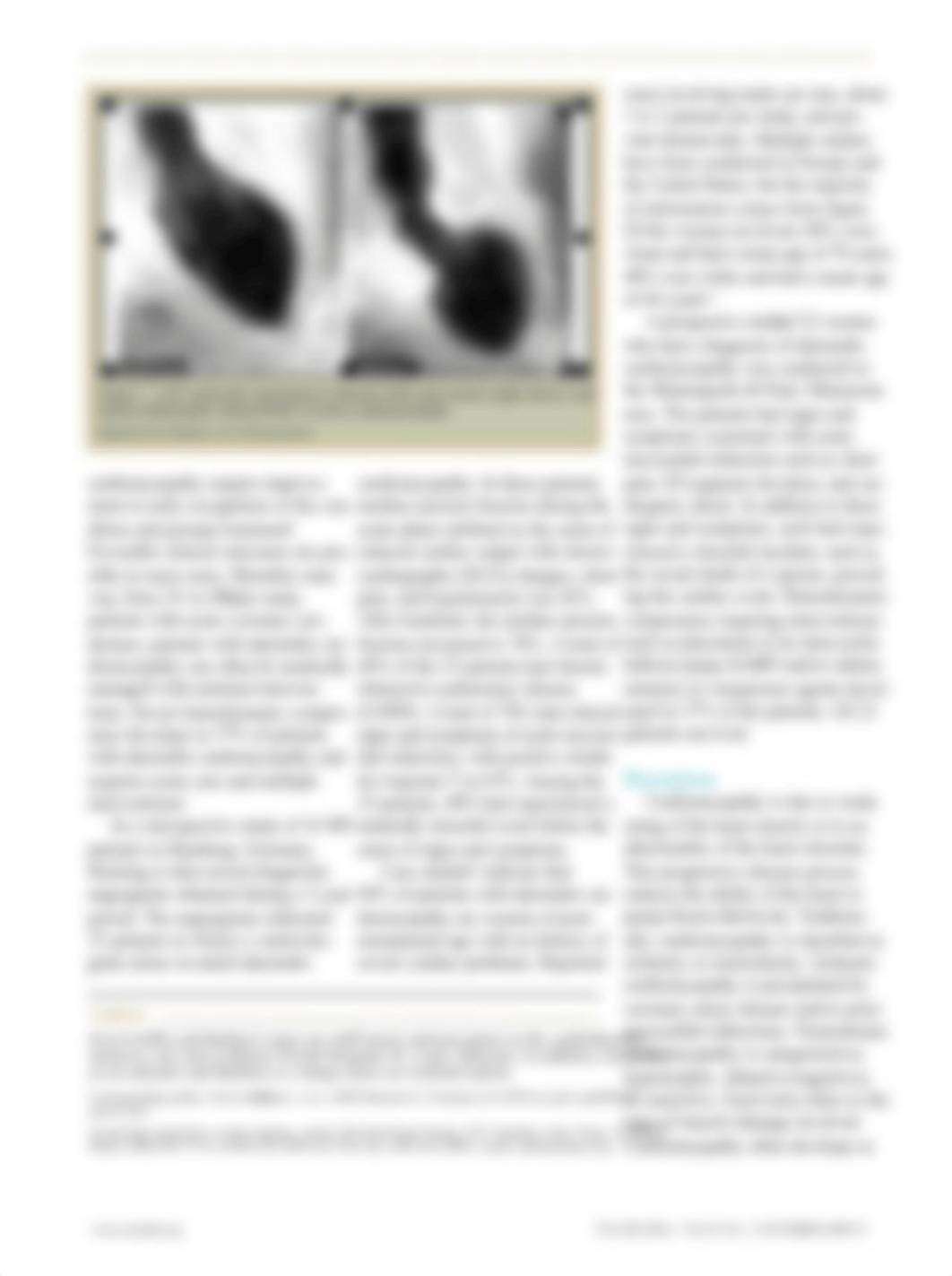 Takotsubo Cardiomyopathy case study_dfgjdu61jf0_page2