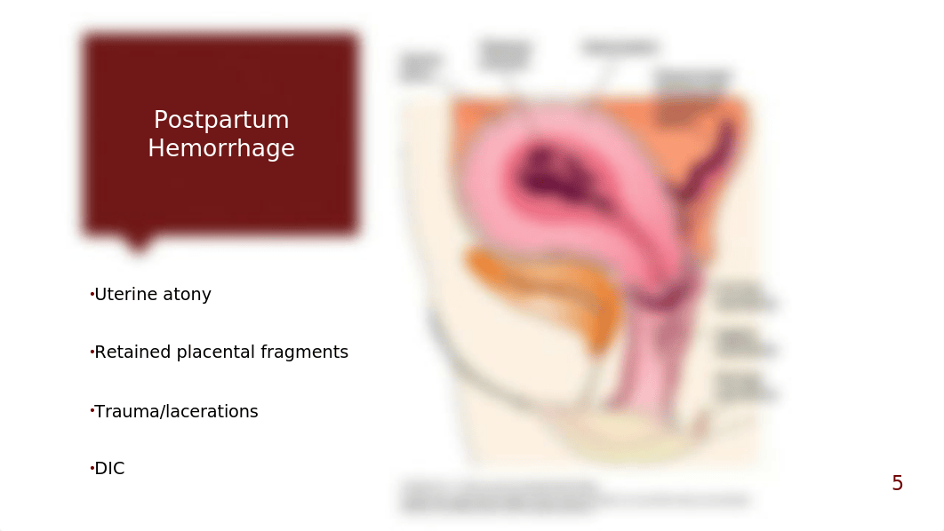 Chapter 16 Postpartum Complications copy.pptx_dfl0wyiuld5_page5