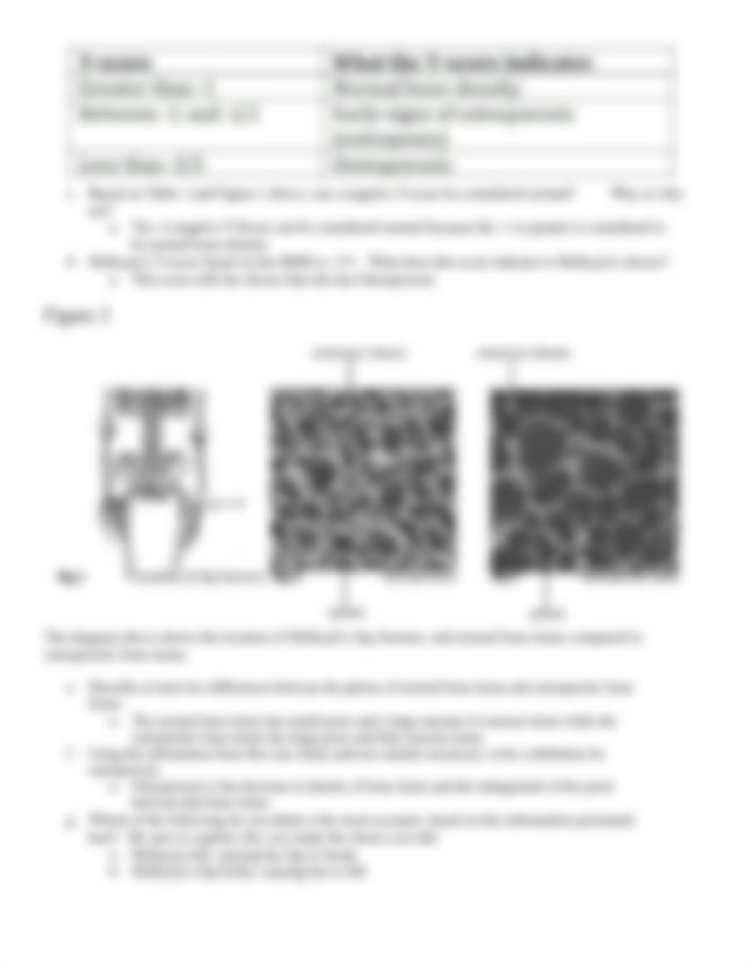 A and P Osteoporosis Activity - complete.docx_dflm79oasvh_page2