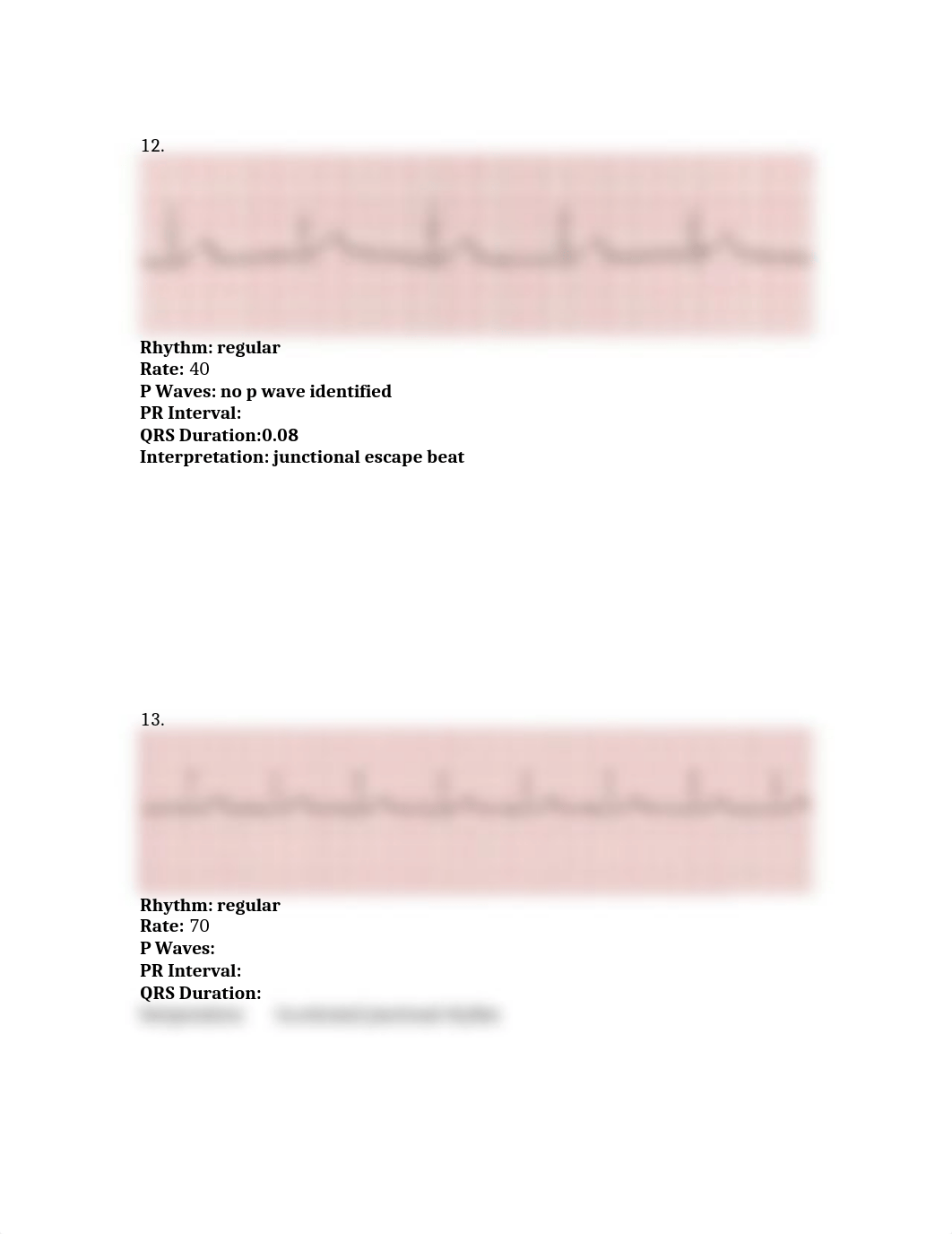 Unit 5 Junctional Rhythm Assignment myisha franklin_dfnfsqej7t5_page2