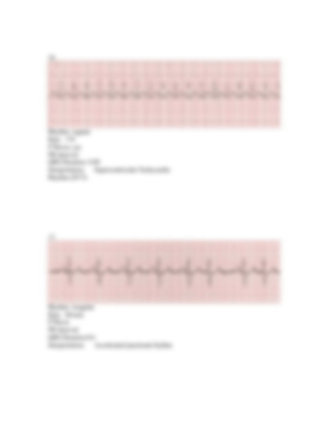 Unit 5 Junctional Rhythm Assignment myisha franklin_dfnfsqej7t5_page4