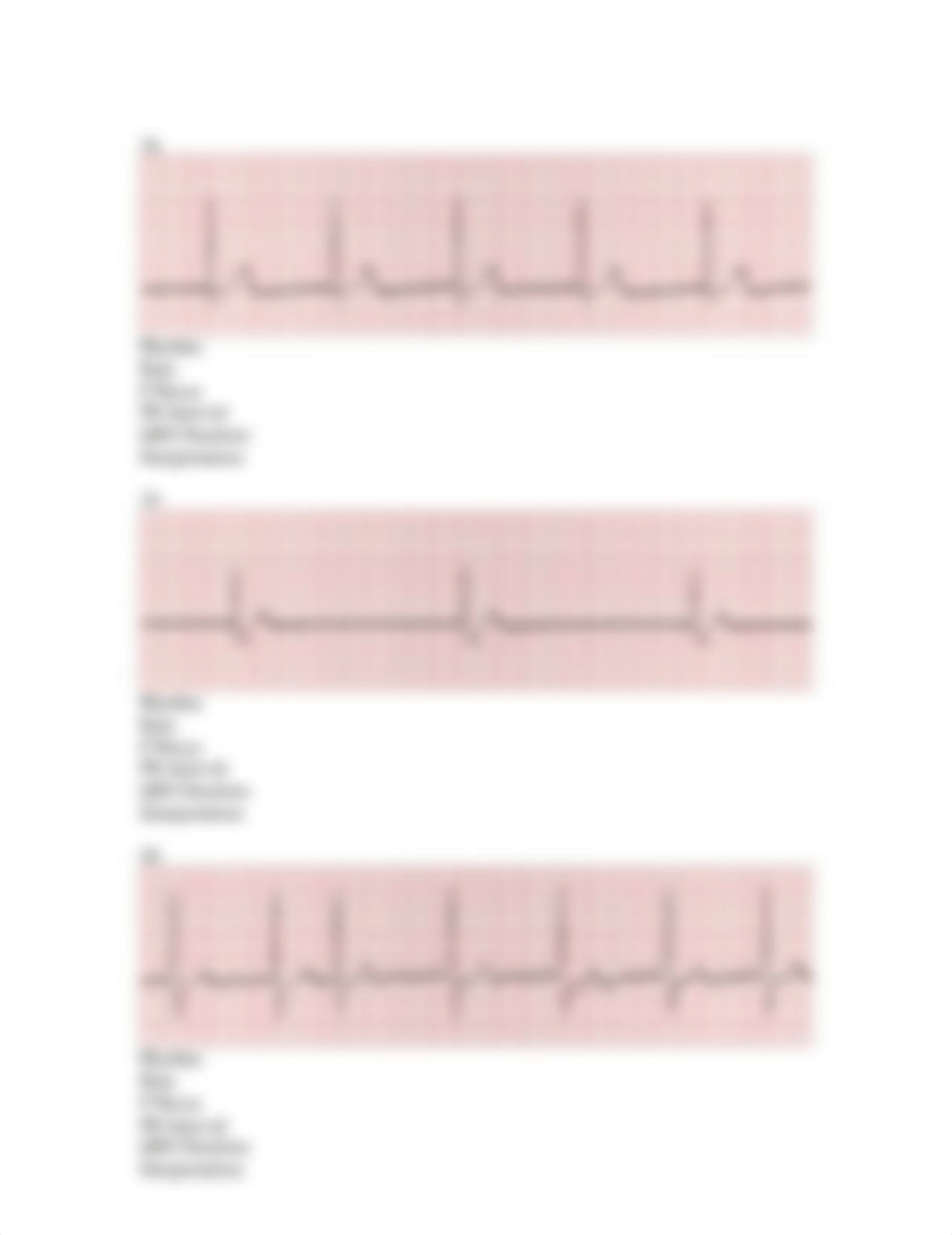 Unit 5 Junctional Rhythm Assignment myisha franklin_dfnfsqej7t5_page5