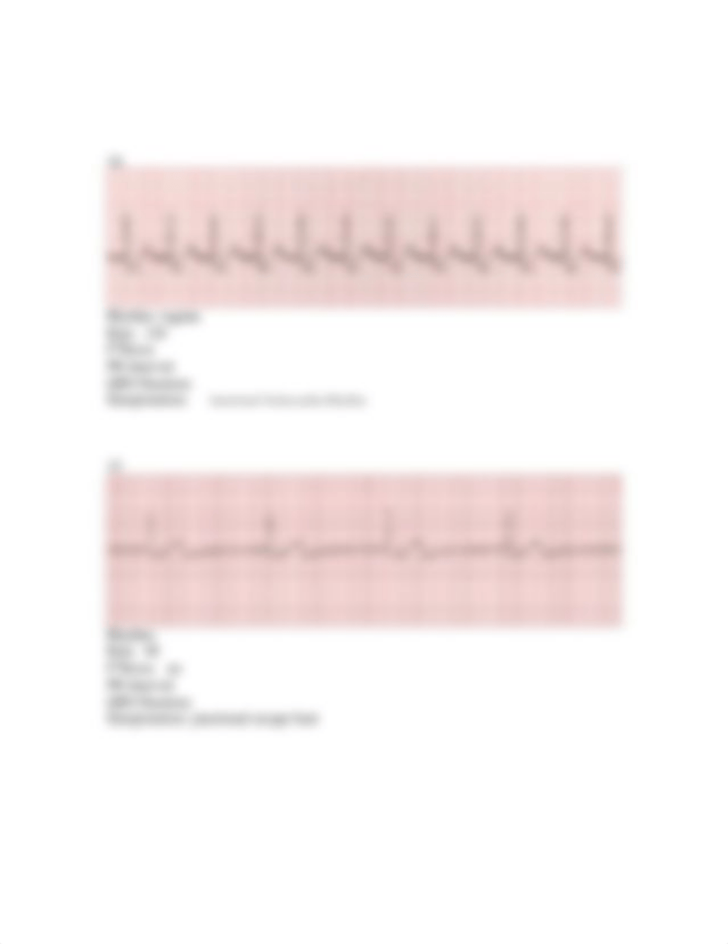 Unit 5 Junctional Rhythm Assignment myisha franklin_dfnfsqej7t5_page3