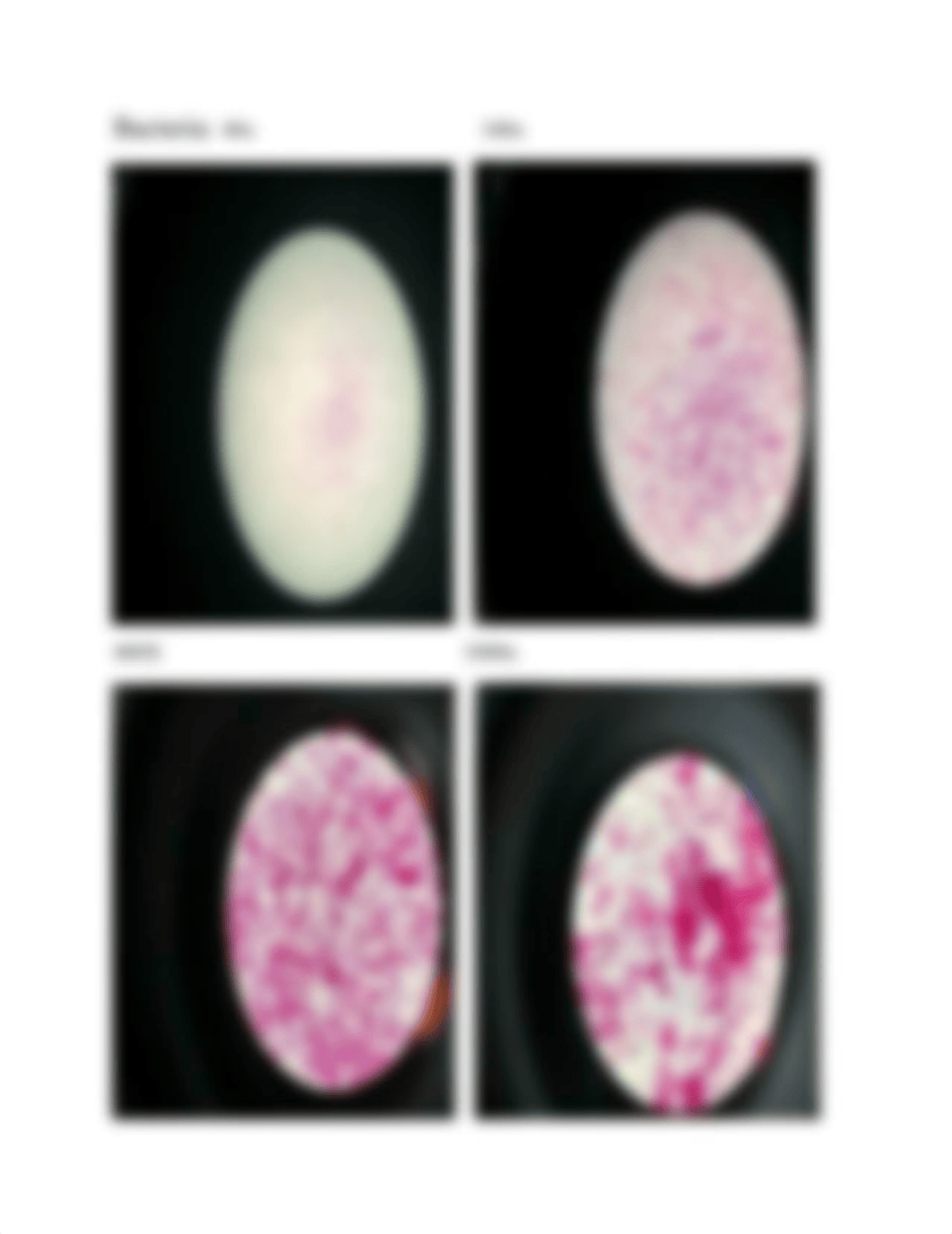 Lab Slides Microbiology Fungi Yeast Molds Protozoa.docx_dftaw95yih0_page5