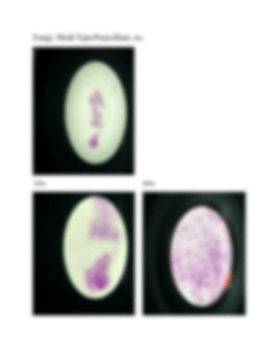 Lab Slides Microbiology Fungi Yeast Molds Protozoa.docx_dftaw95yih0_page3